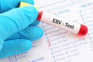 mono, mononucleosis, Epstein-Barr virus, EBV